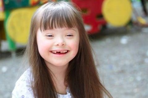 关于唐氏儿在宫内有什么特征吗?